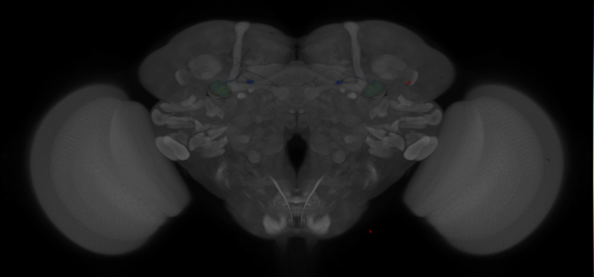 JRC_MB112C_Brain_2014_20121208_32_D1_20x