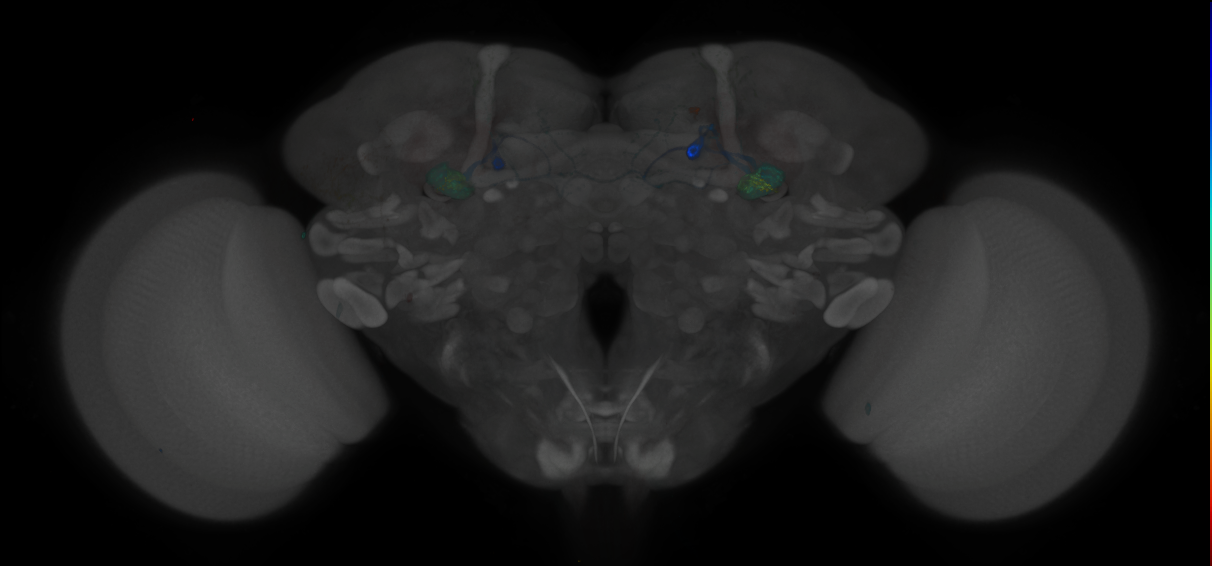 JRC_MB112C_Brain_2014_20121208_32_D2_20x