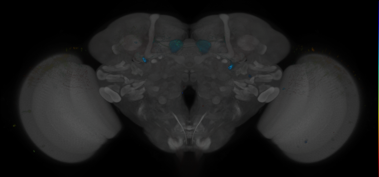 JRC_MB298B_Brain_2014_20121208_32_G1_20x