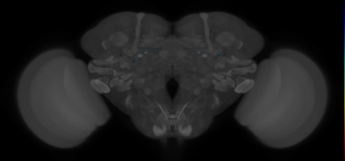 JRC_MB433B_Brain_2014_20121208_32_H2_20x