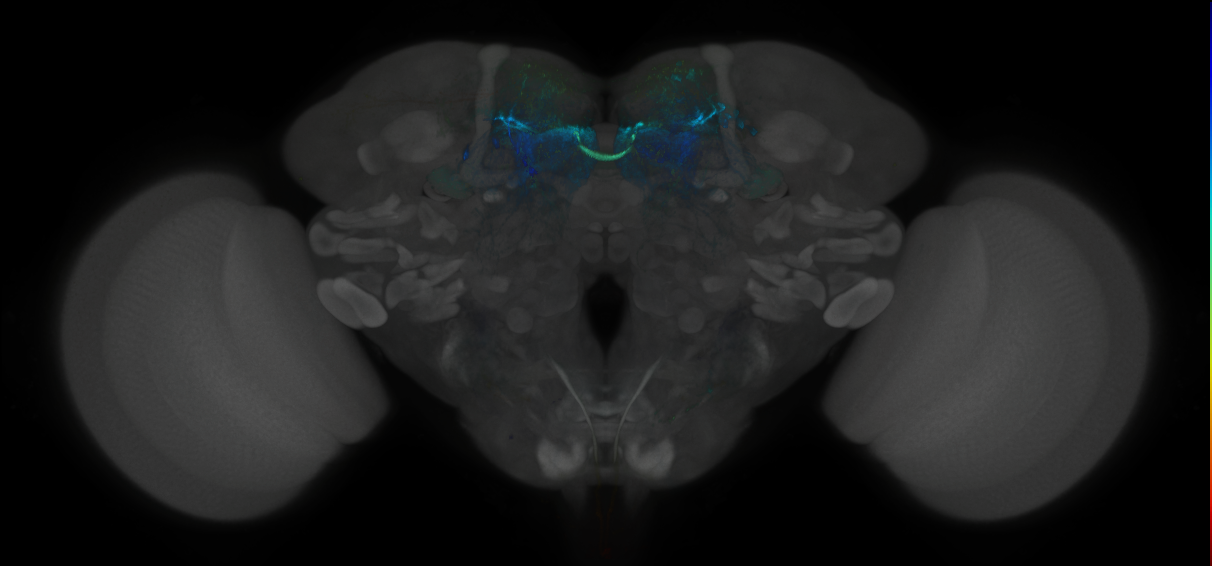 JRC_MB042B_Brain_2014_20121127_32_C2_20x