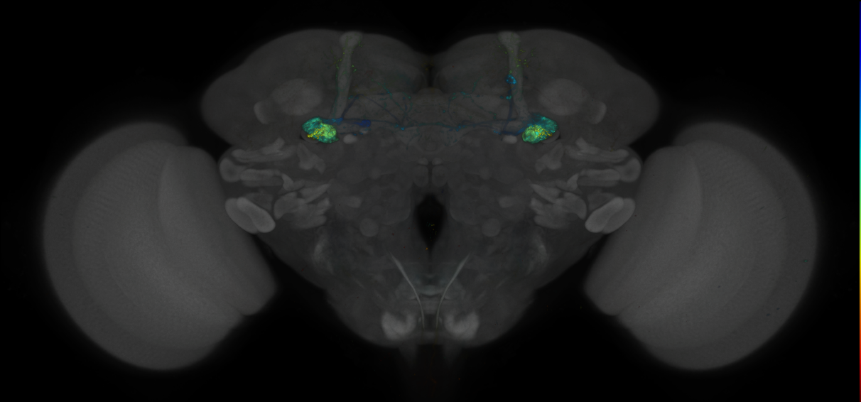 JRC_MB112C_Brain_2014_20131222_31_A2_20x