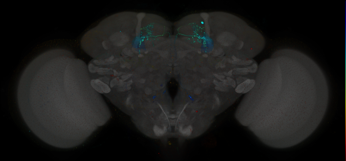 JRC_MB051B_Brain_2014_20140401_31_C4_20x