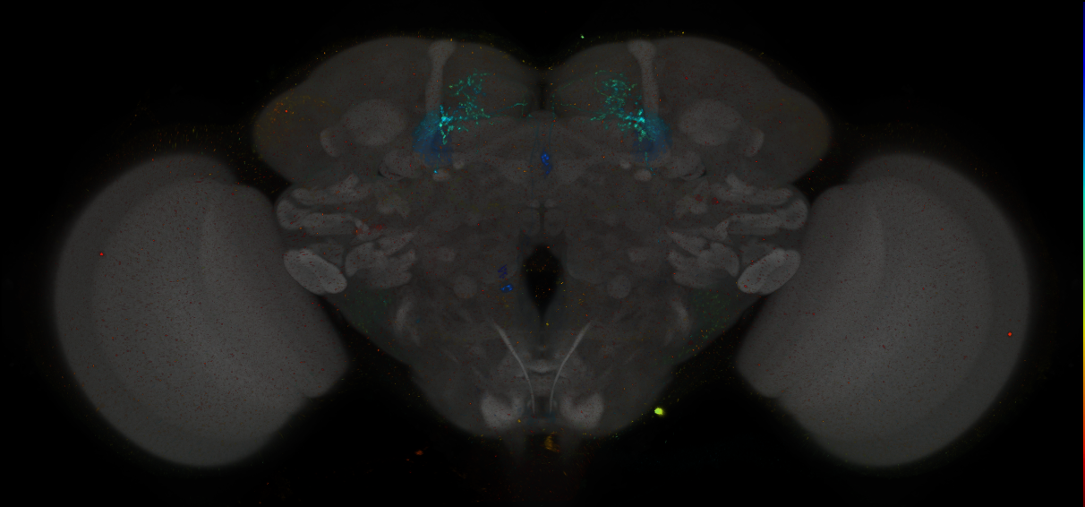 JRC_MB051B_Brain_2014_20140401_31_C5_20x