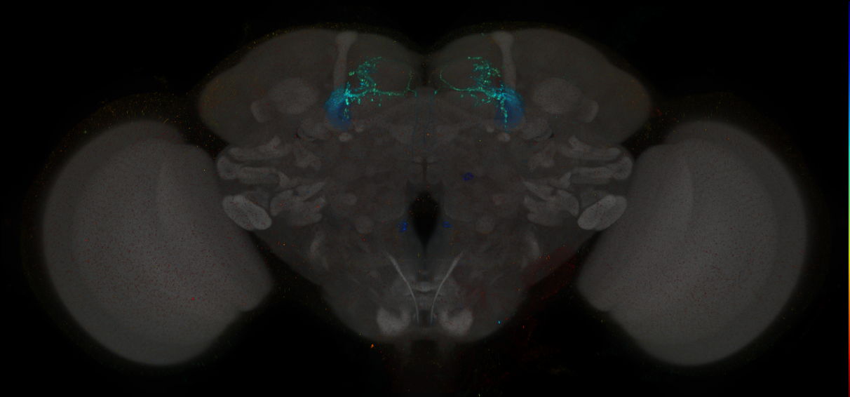 JRC_MB077B_Brain_2014_20140401_31_E1_20x