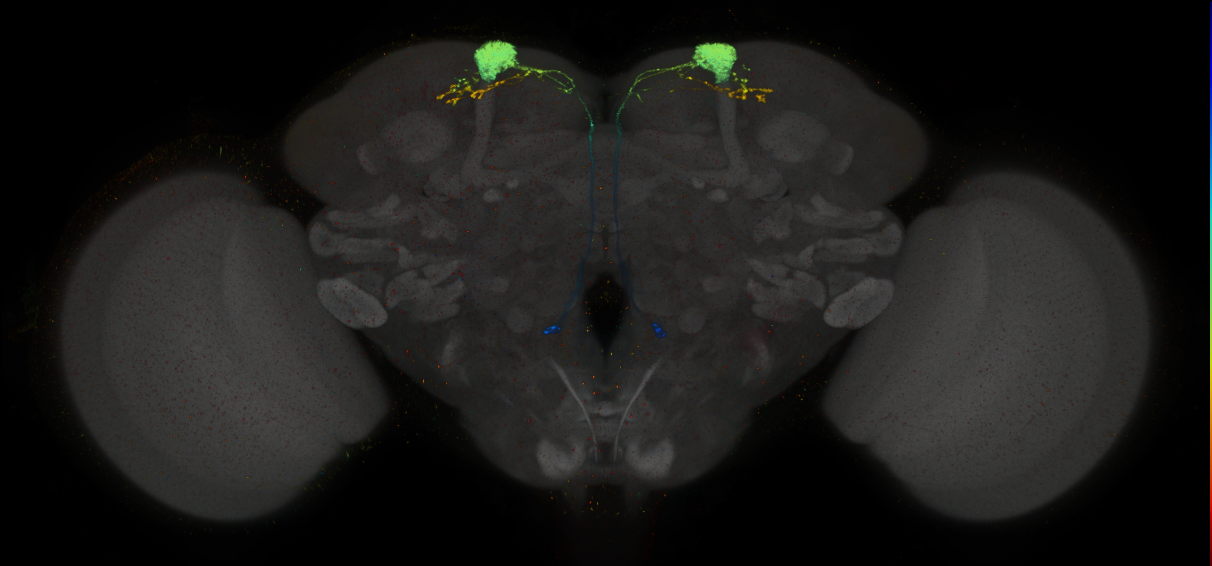 JRC_MB093C_Brain_2014_20140407_31_C1_20x