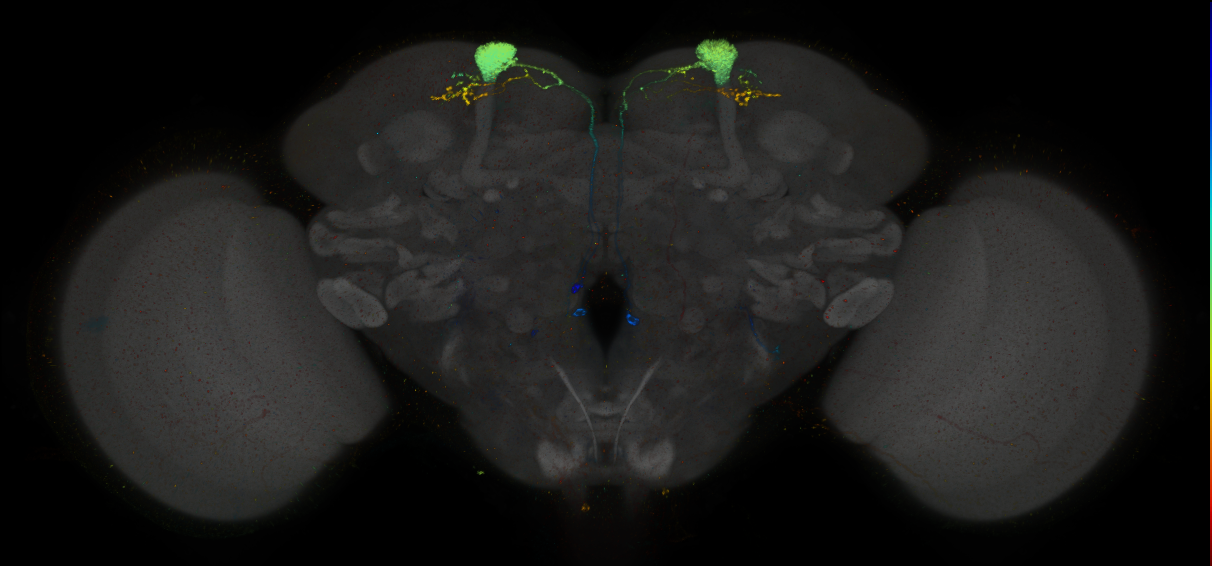 JRC_MB093C_Brain_2014_20140407_31_C2_20x