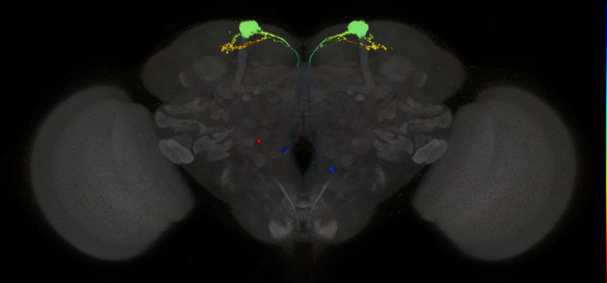 JRC_MB093C_Brain_2014_20140407_31_C3_20x