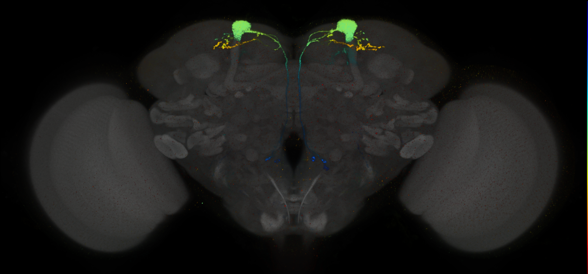 JRC_MB093C_Brain_2014_20140407_31_C4_20x