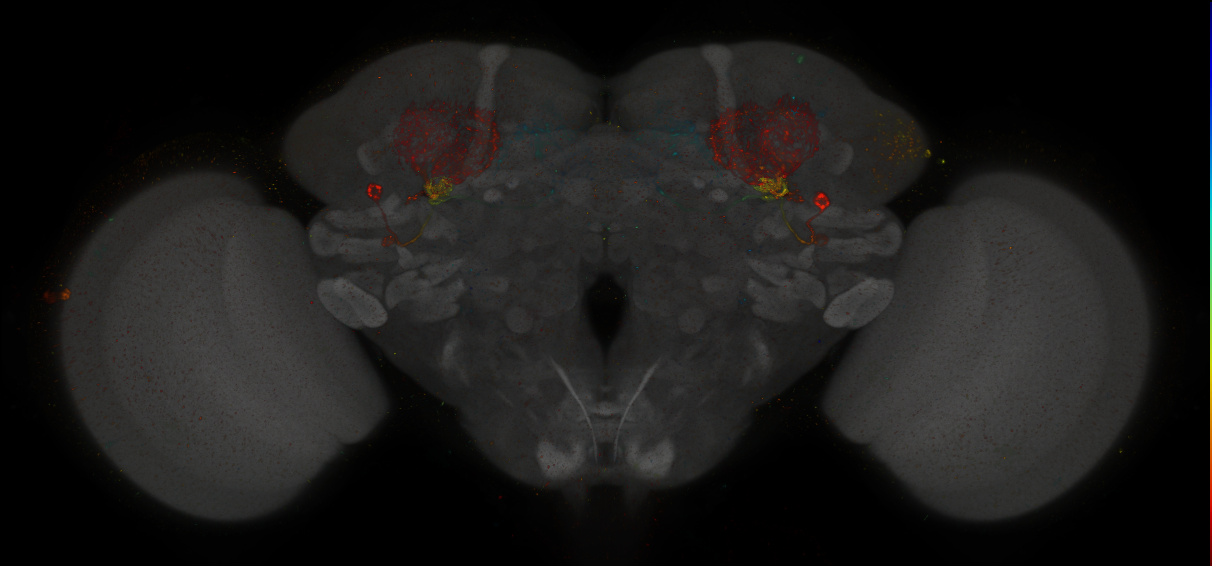 JRC_MB242A_Brain_2014_20140407_32_C3_20x