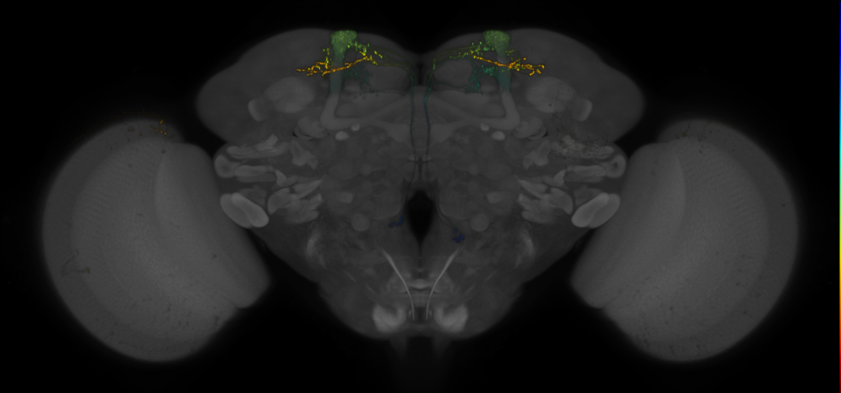 JRC_MB082C_Brain_2014_20140401_32_D1_20x