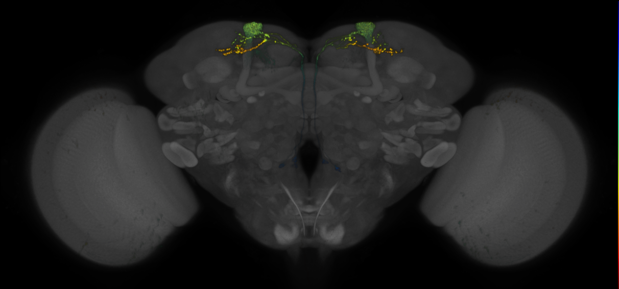 JRC_MB082C_Brain_2014_20140401_32_D2_20x