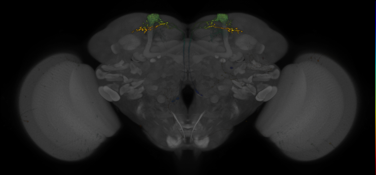 JRC_MB082C_Brain_2014_20140401_32_D3_20x