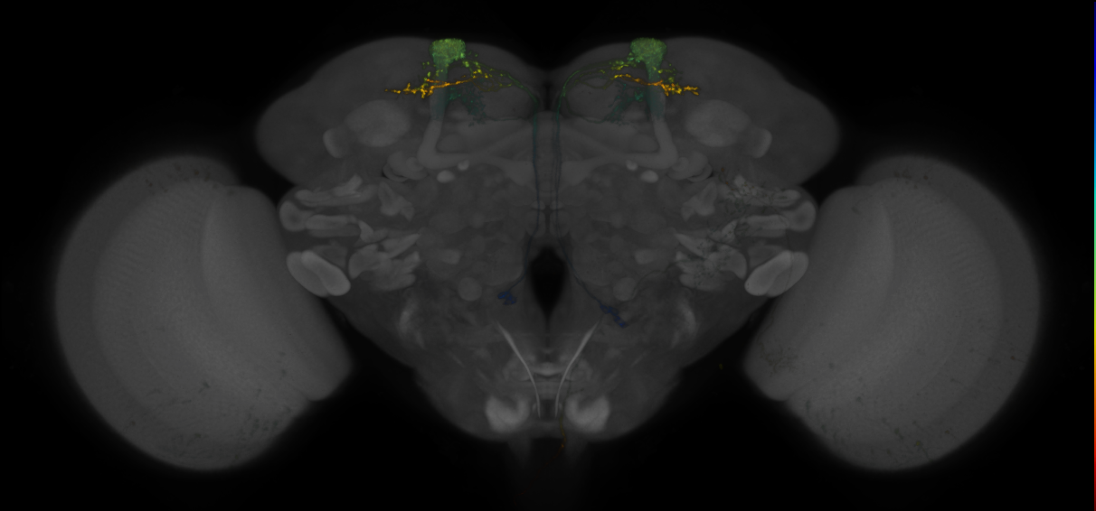 JRC_MB082C_Brain_2014_20140401_32_D5_20x