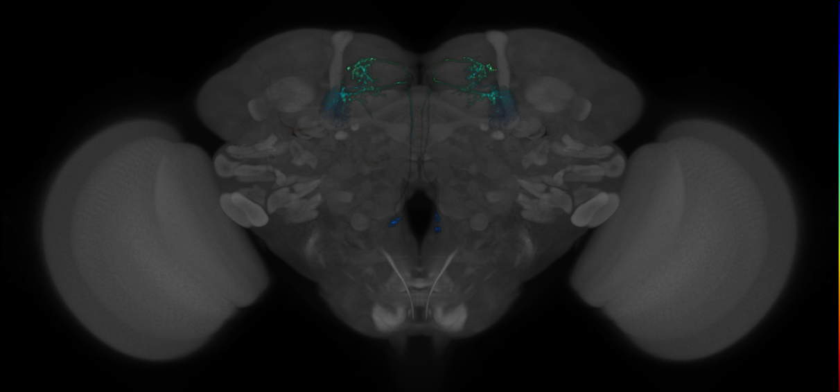 JRC_MB077B_Brain_2014_20140401_32_F3_20x