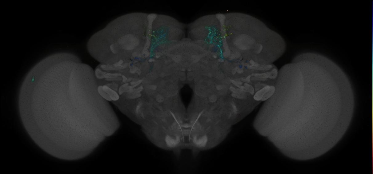 JRC_MB057B_Brain_2014_20140410_32_A1_20x