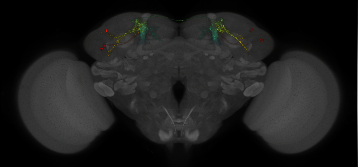 JRC_MB050B_Brain_2014_20140410_32_G2_20x
