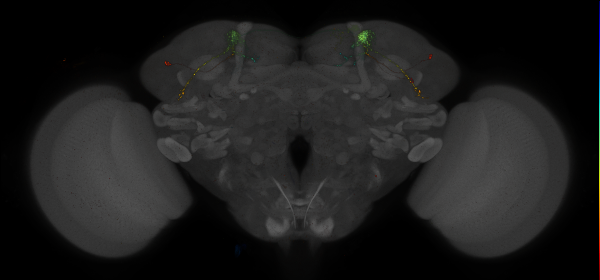 JRC_MB542B_Brain_2014_20140410_32_H1_20x