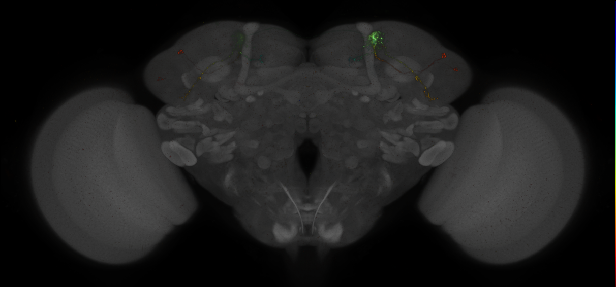 JRC_MB542B_Brain_2014_20140410_32_H2_20x