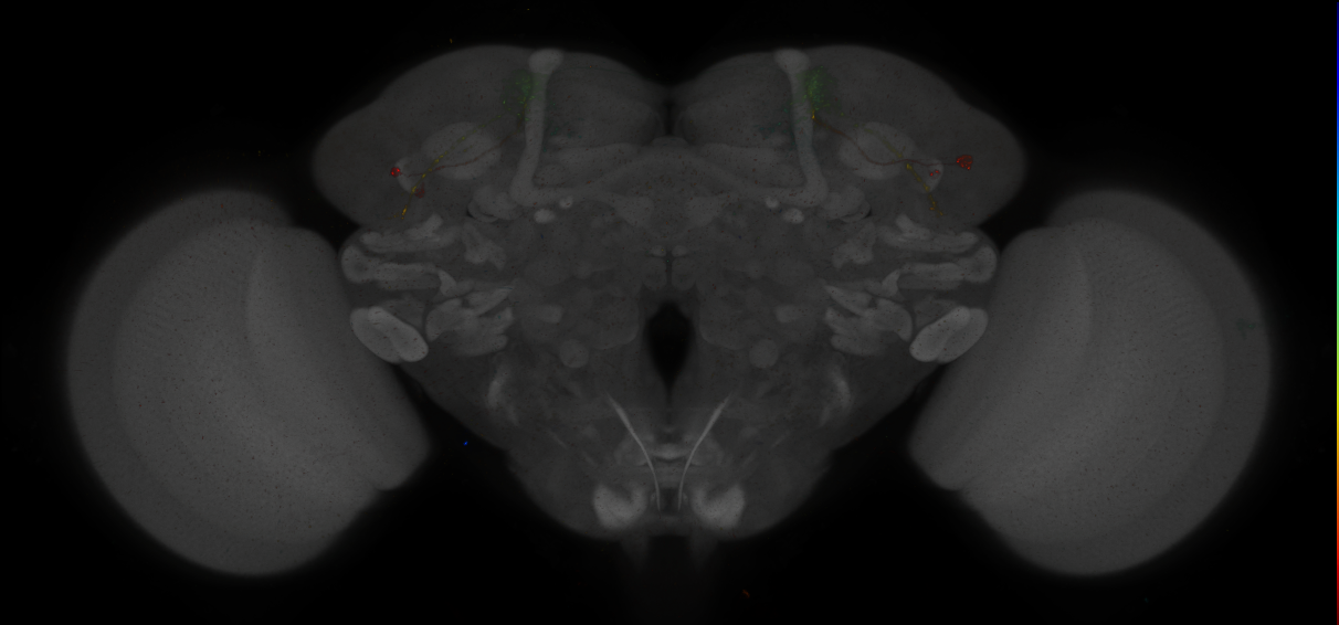 JRC_MB542B_Brain_2014_20140410_32_H3_20x