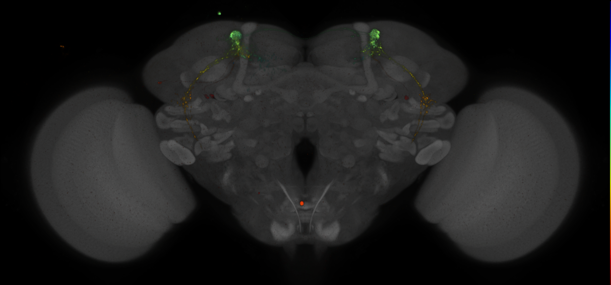 JRC_MB027B_Brain_2014_20140410_32_J2_20x
