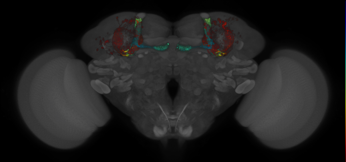 JRC_MB418B_Brain_2014_20140410_31_E4_20x