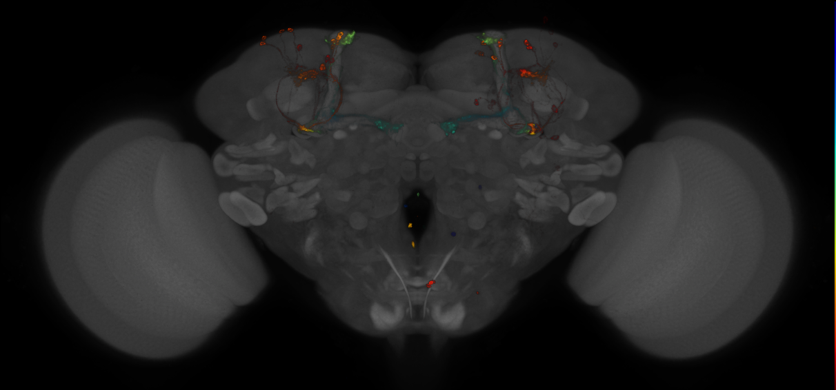 JRC_MB371B_Brain_2014_20140410_31_J3_20x