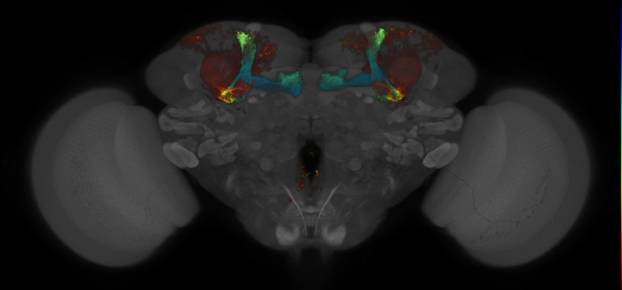 JRC_MB005B_Brain_2014_20140409_31_B1_20x