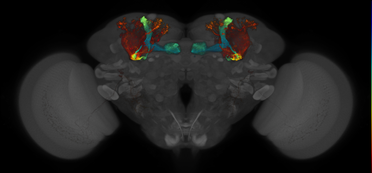 JRC_MB005B_Brain_2014_20140409_31_B2_20x