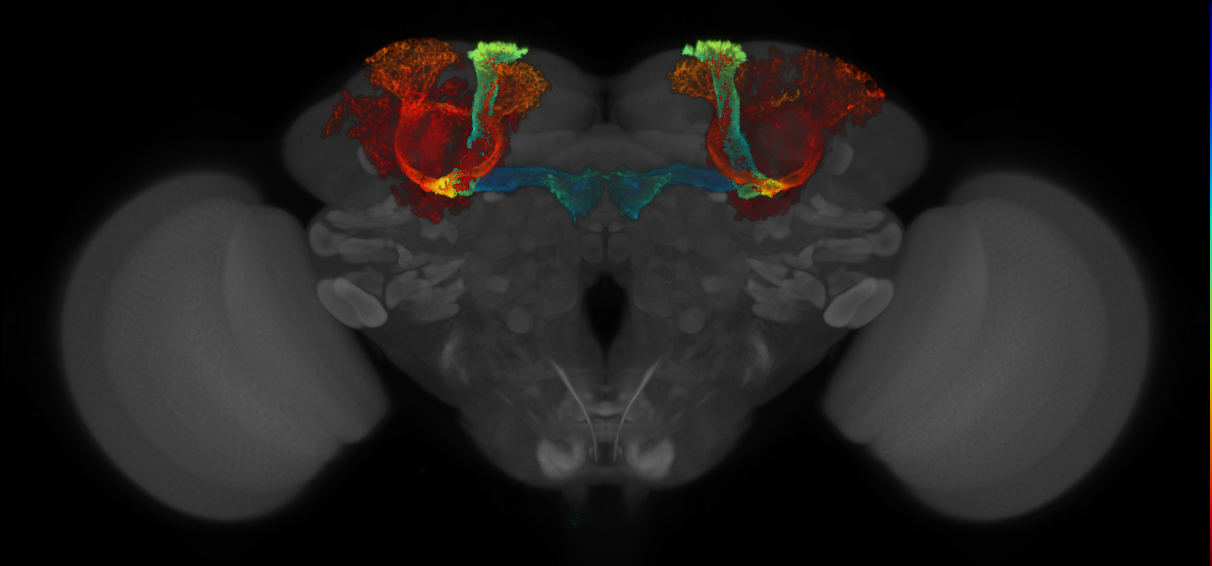 JRC_MB008B_Brain_2014_20140409_31_H2_20x