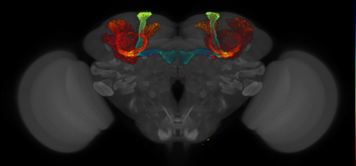 JRC_MB008B_Brain_2014_20140409_31_H3_20x