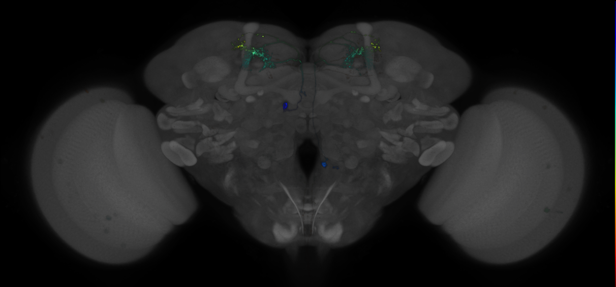JRC_MB018B_Brain_2014_20140407_33_D1_20x