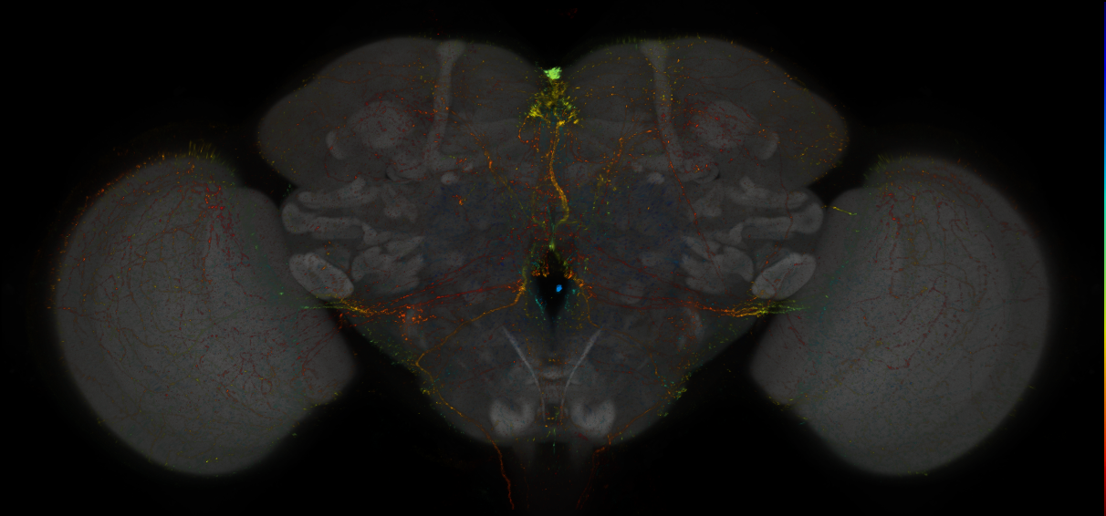 JRC_MB013B_Brain_2014_20140408_31_B1_20x