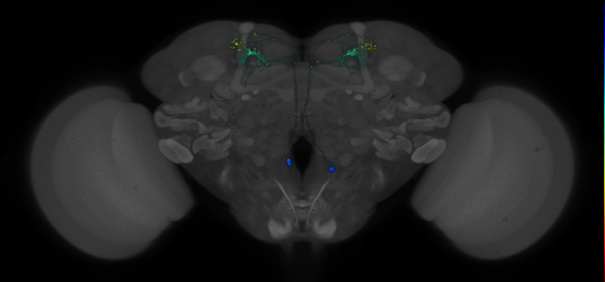 JRC_MB018B_Brain_2014_20140407_33_D3_20x