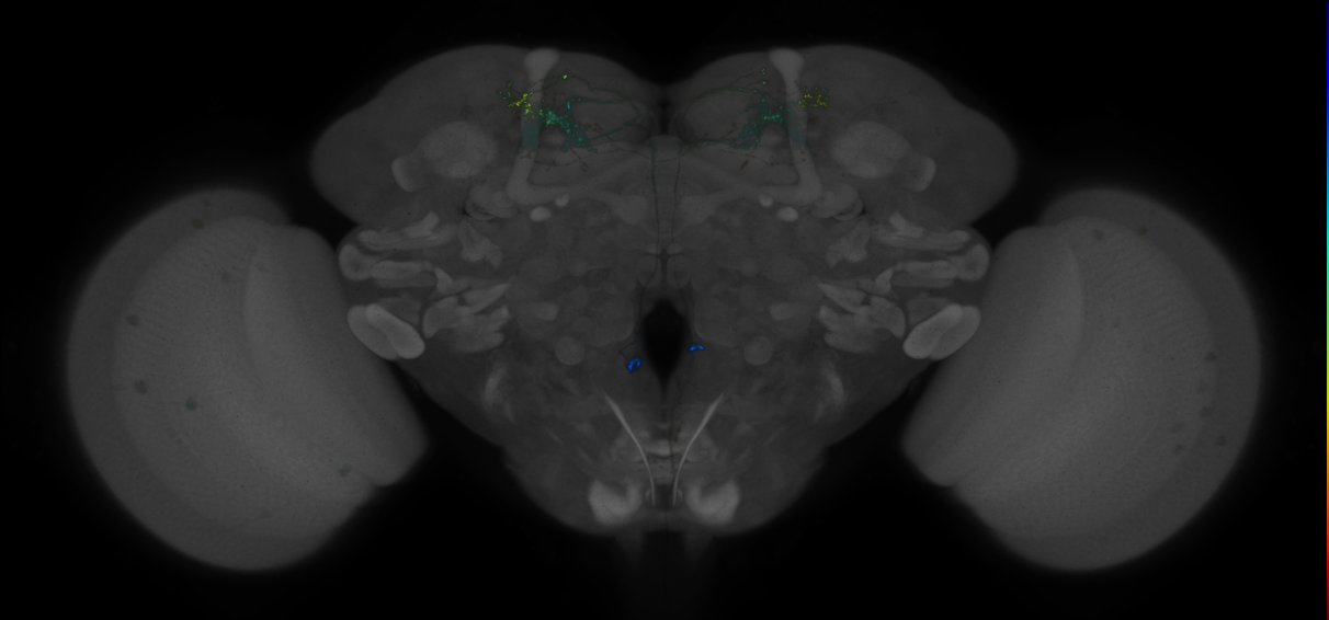 JRC_MB018B_Brain_2014_20140407_33_D4_20x