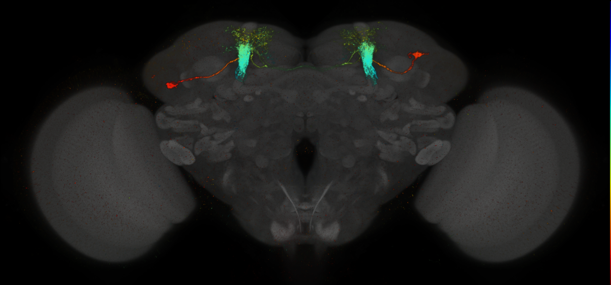 JRC_MB058B_Brain_2014_20140411_31_A2_20x
