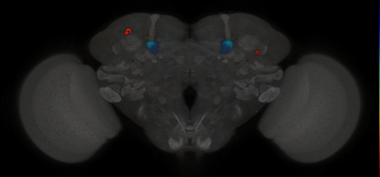 JRC_MB296B_Brain_2014_20140411_31_B1_20x