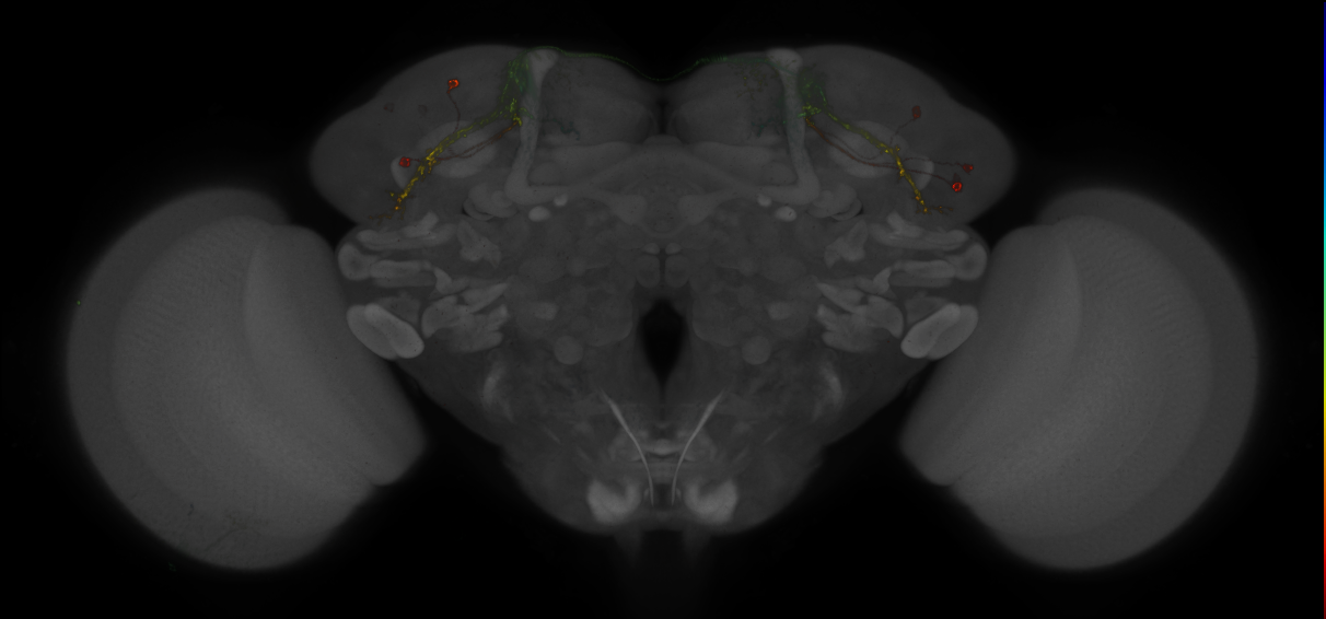 JRC_MB542B_Brain_2014_20140407_33_F1_20x