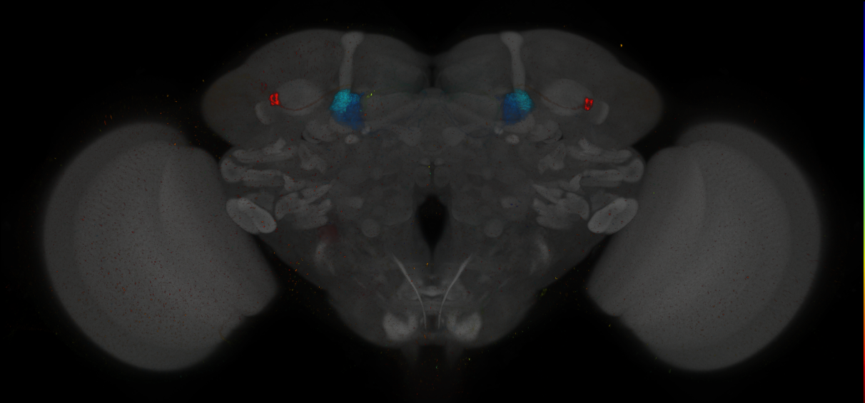 JRC_MB296B_Brain_2014_20140411_31_B2_20x