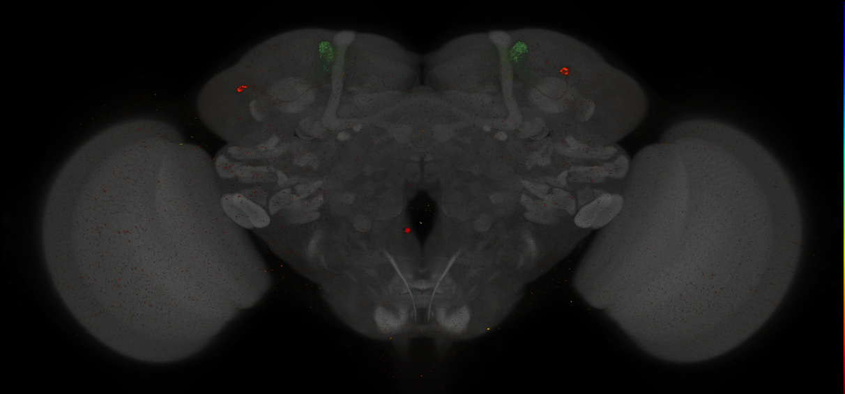 JRC_MB304B_Brain_2014_20140411_31_C1_20x