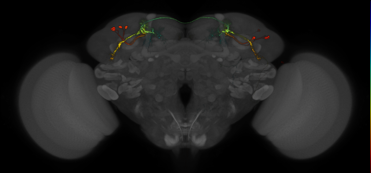 JRC_MB543B_Brain_2014_20140407_33_G2_20x