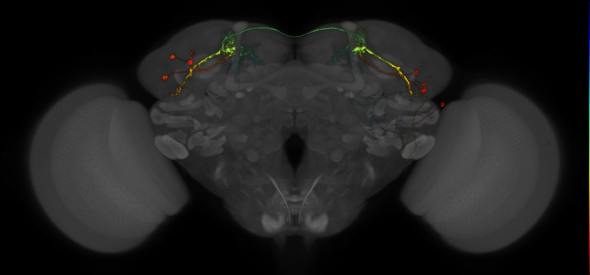 JRC_MB543B_Brain_2014_20140407_33_G3_20x