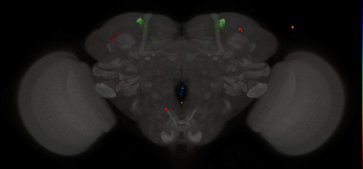 JRC_MB304B_Brain_2014_20140411_31_C3_20x