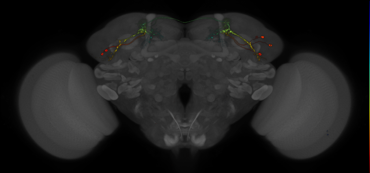 JRC_MB543B_Brain_2014_20140407_33_G4_20x