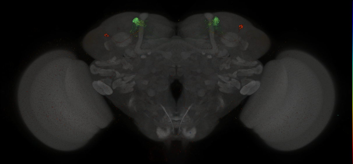 JRC_MB304B_Brain_2014_20140411_31_C4_20x