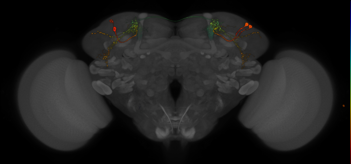 JRC_MB549C_Brain_2014_20140407_33_H1_20x