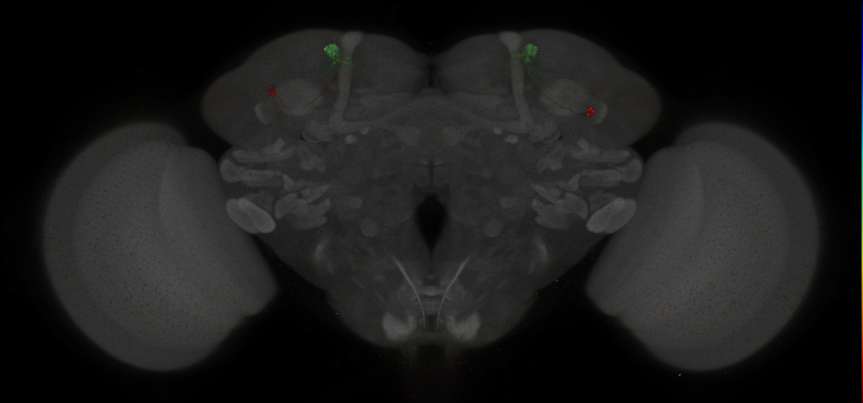 JRC_MB304B_Brain_2014_20140411_31_C5_20x