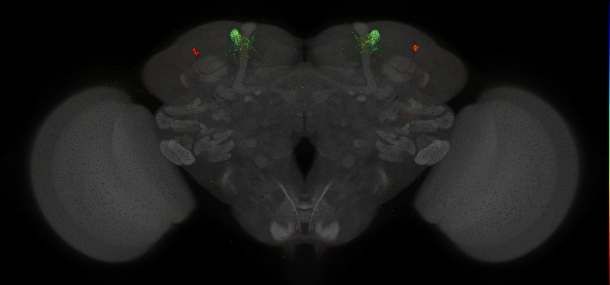 JRC_MB308B_Brain_2014_20140411_31_D2_20x