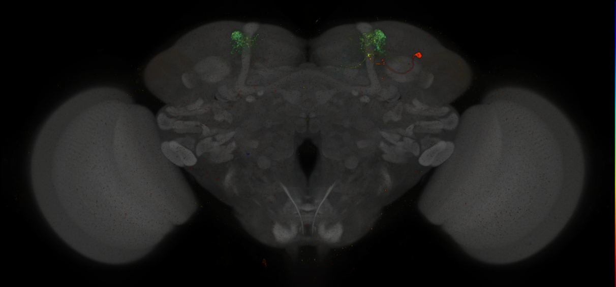 JRC_MB308B_Brain_2014_20140411_31_D3_20x