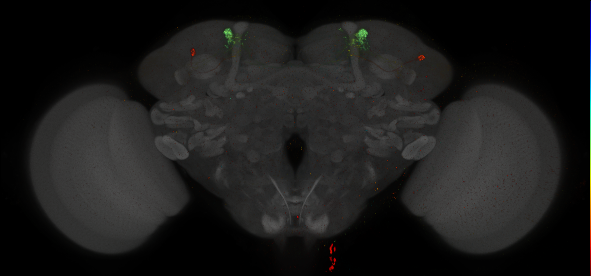 JRC_MB308B_Brain_2014_20140411_31_D4_20x